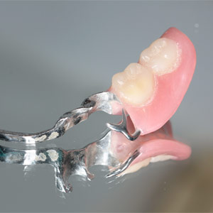 Próteses dentárias removíveis